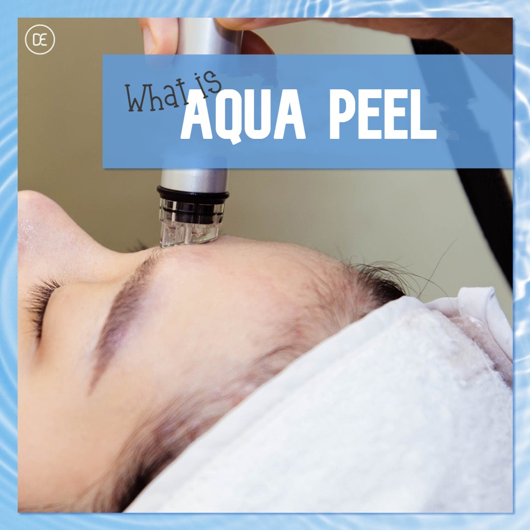 Aqua Peel